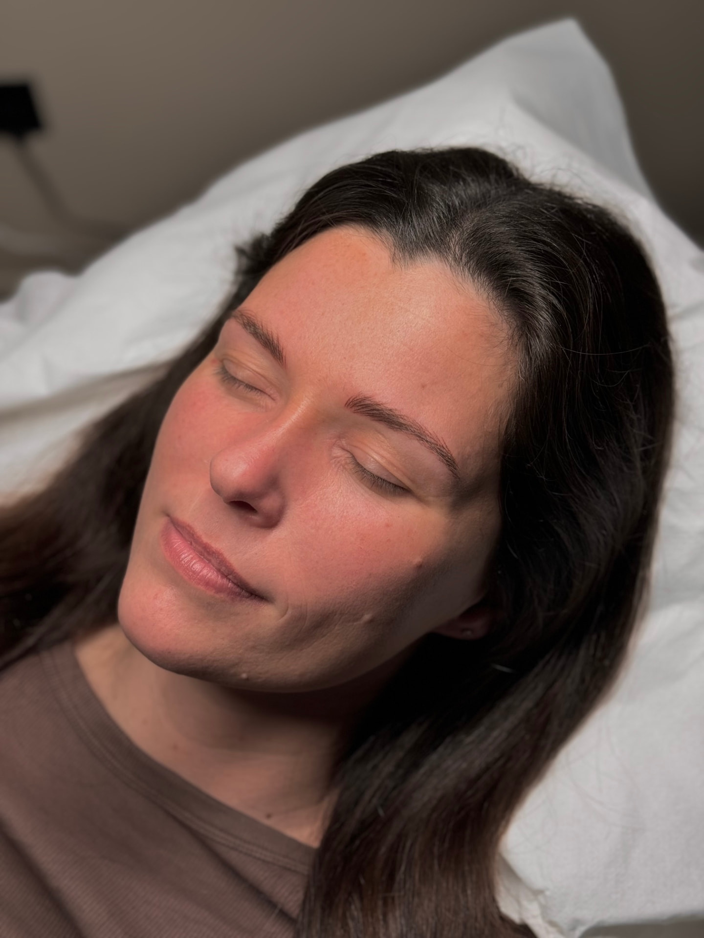 Client 1 before brow treatment