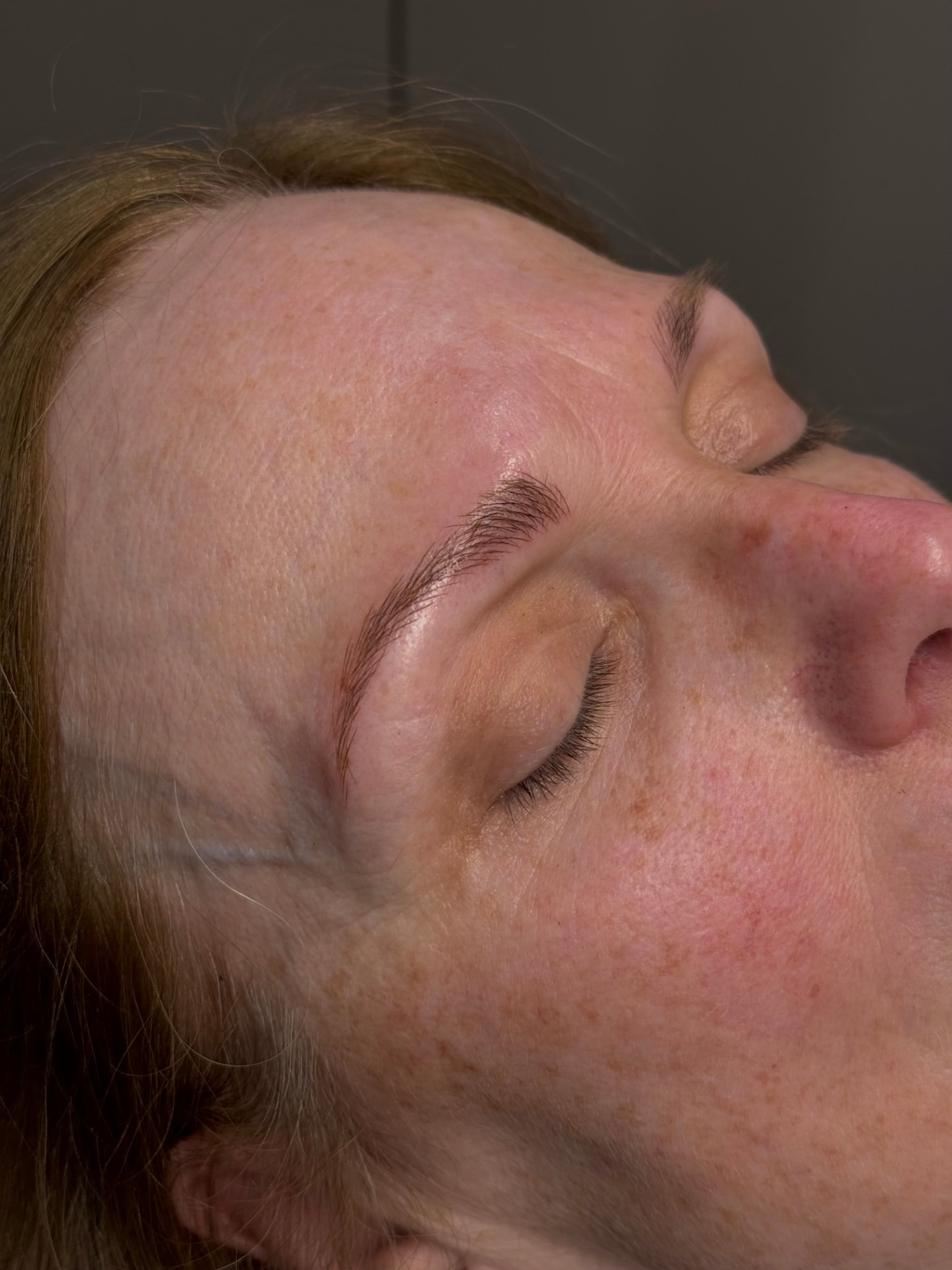 Client 3 after brow treatment