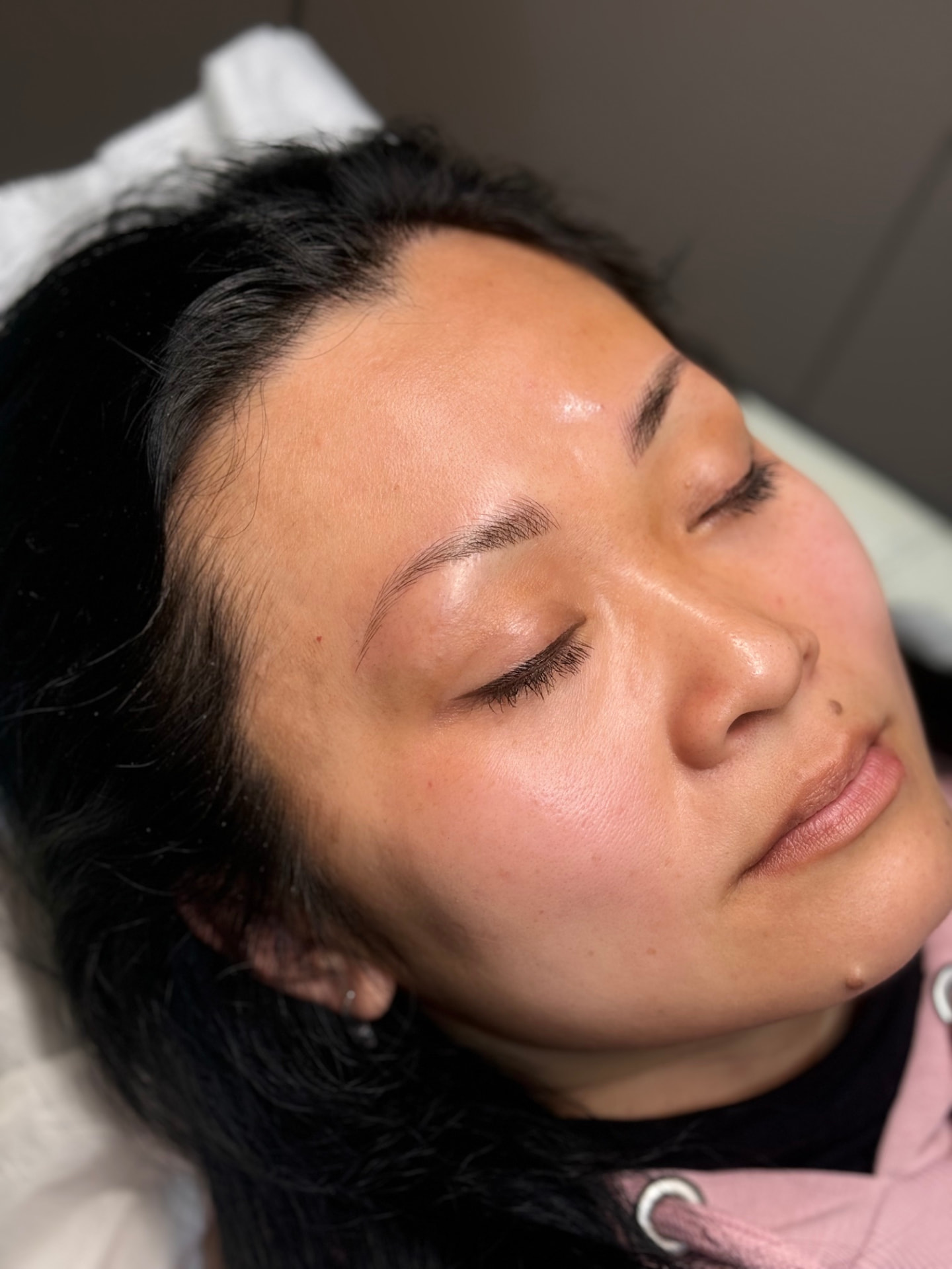 Client 6 after brow treatment