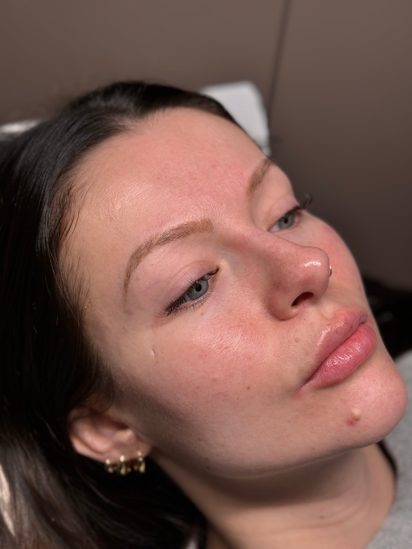 Client 2 before brow treatment