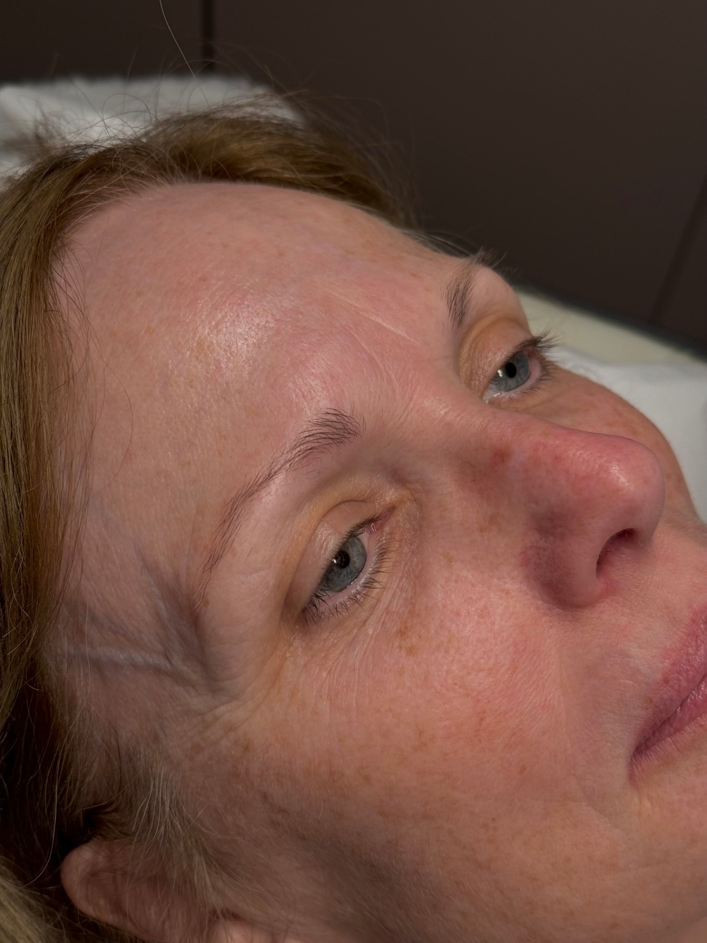 Client 3 before brow treatment