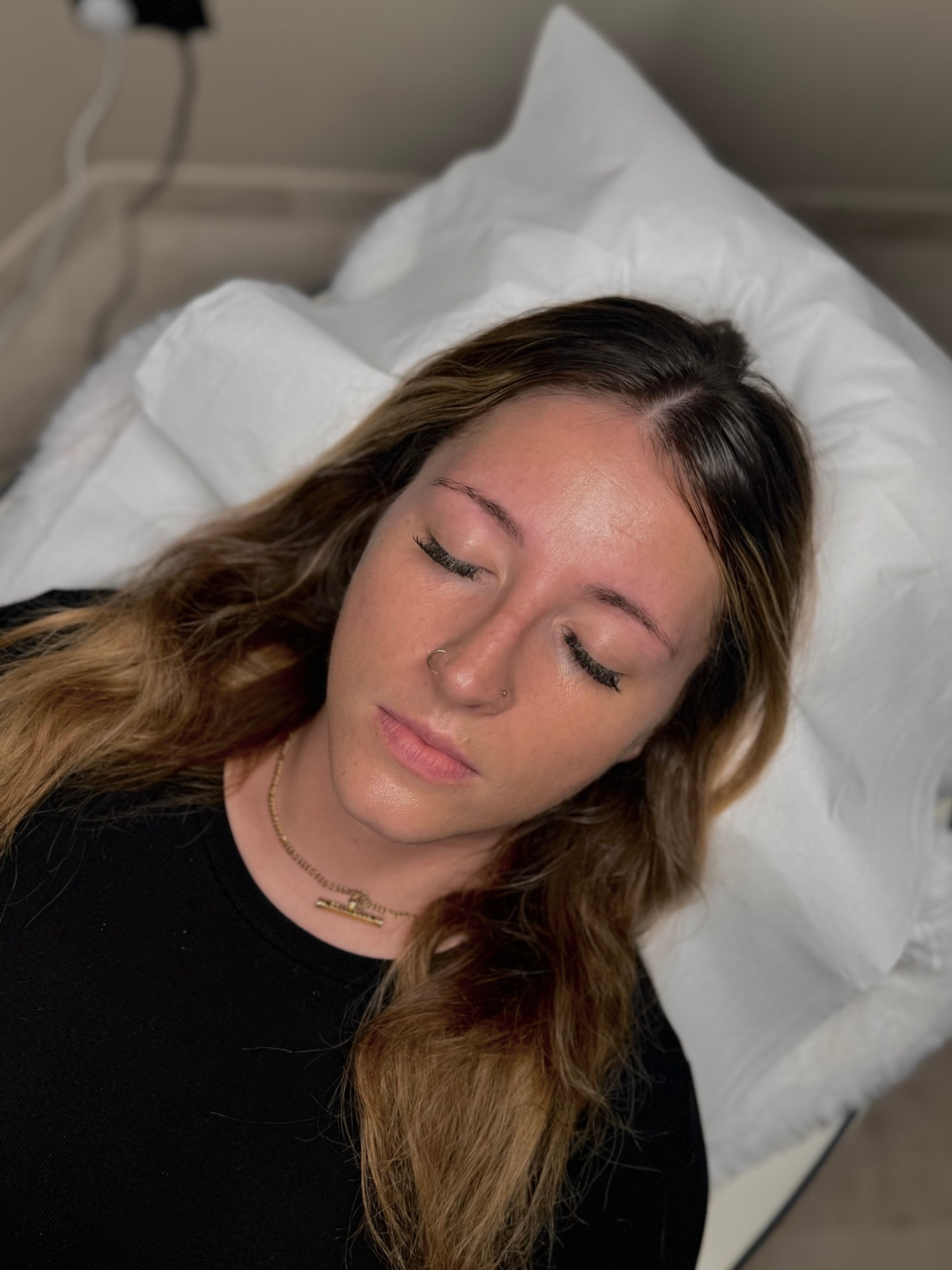 Client 4 before brow treatment